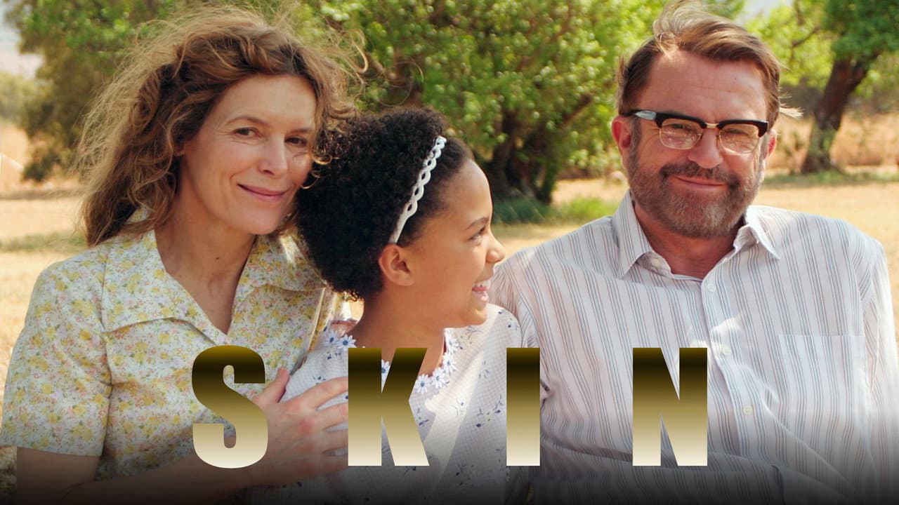Skin still 6