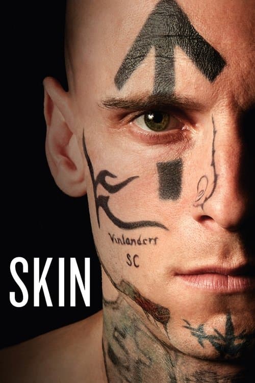 Skin still 8